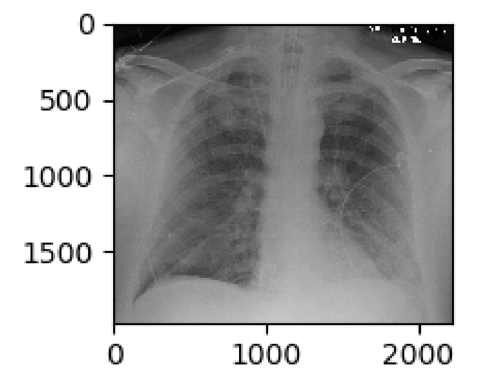 El sistema procesa una imagen de rayos X, obtiene características automáticamente de las imágenes usando técnicas de aprendizaje de máquina (machine learning) y produce un diagnóstico.